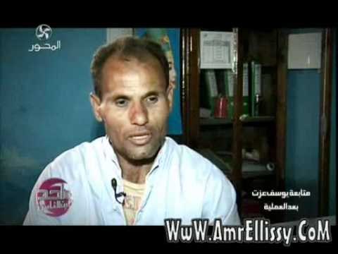 عمرو الليثي ومتابعة حالة يوسف عزت بعد العملية
