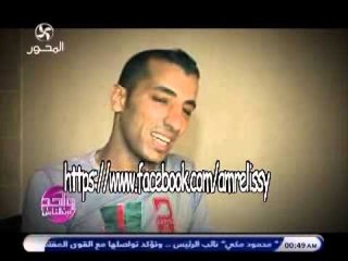 برنامج واحد من الناس متابعة تركيب طرف صناعي لصالح