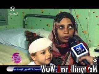 متابعة الطفلة ملك بعد العملية مع د عمرو الليثي