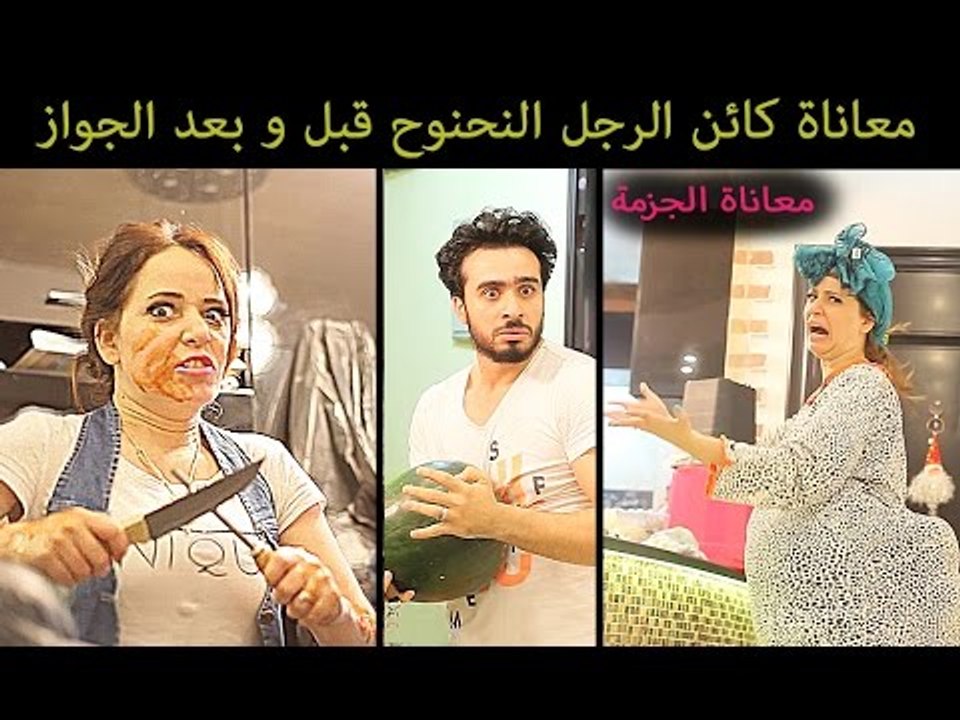 Mohamed Aamer  - ( معاناة الرجل النحنوح قبل وبعد الجواز ( الجزمة