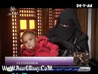 واحد من الناس  متابعة علاج حالة حروق