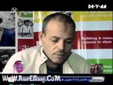 واحد من الناس  متابعة تسليم طرف صناعي