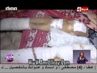 #واحد من الناس | متابعة حالة صفاء محمد بعد العملية | مع د.عمرو الليثي