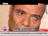#واحد من الناس | متابعة حالة الحاج مصطفي بعد العملية | مع د.عمرو الليثي