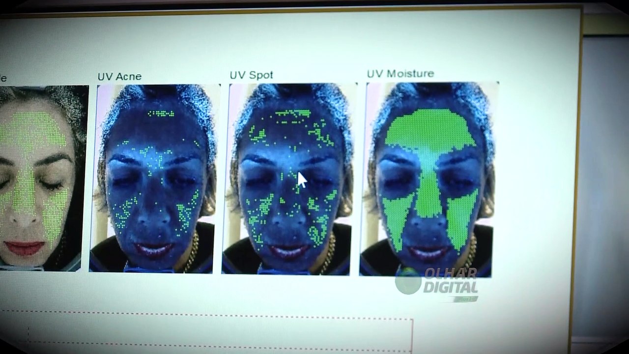 Como a tecnologia e inteligência artificial estão mudando a dermatologia