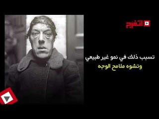 اتفرج | أبشع امرأة في العالم