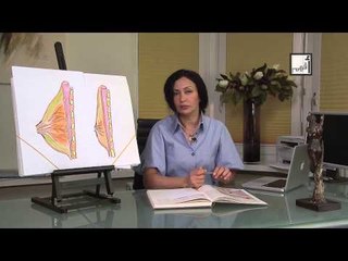 Alyaa Gad - Gynecomastia تضخم الثدي عند الذكور