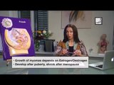 Alyaa Gad - Uterine Fibroids (Myomas)