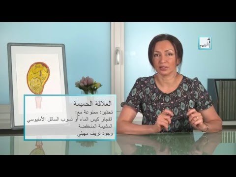 Alyaa Gad - Inducing Labor تحفيز الولادة