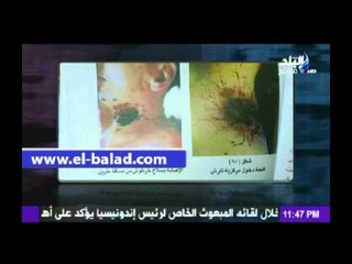المتحدث باسم الطب الشرعي يكشف لـ "أحمد موسي" تفاصيل مقتل شيماء الصباغ