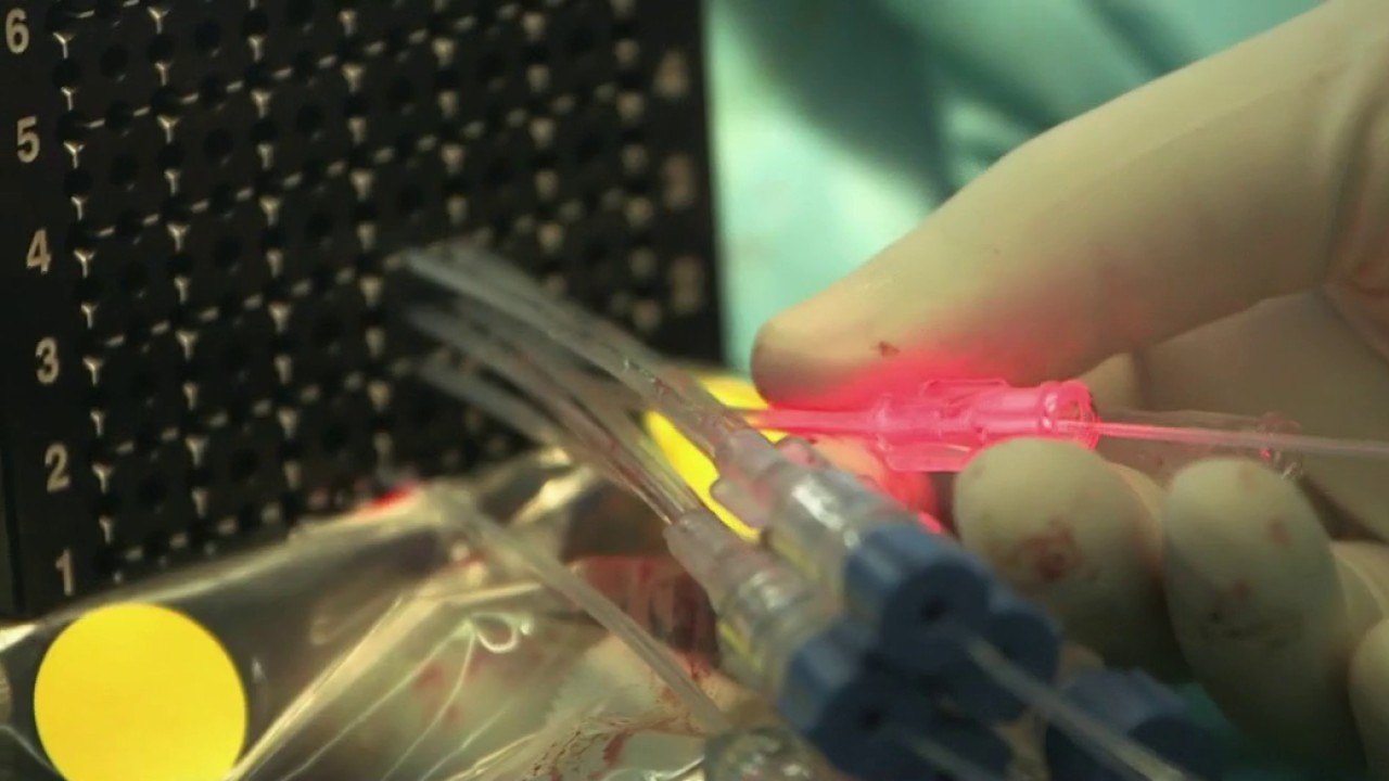 Santé - Cancer de la prostate : un nouveau traitement révolutionne la qualité de vie des patients