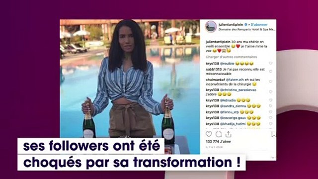 Manon Marsault : Défigurée par la chirurgie ? Le cliché qui choque les internautes !