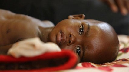I bambini, le prime vittime dell'instabilità nella Repubblica Centrafricana