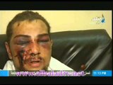 الاعتداء على مواطن من قبل معتصمى رابعة العدوية