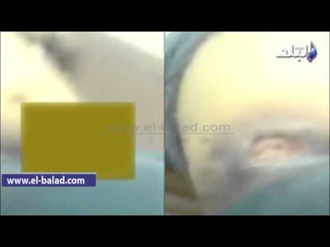 صدى البلد |الإهمال الطبى بمستشفى حوش عيسى يصيب طفل بـ التسمم