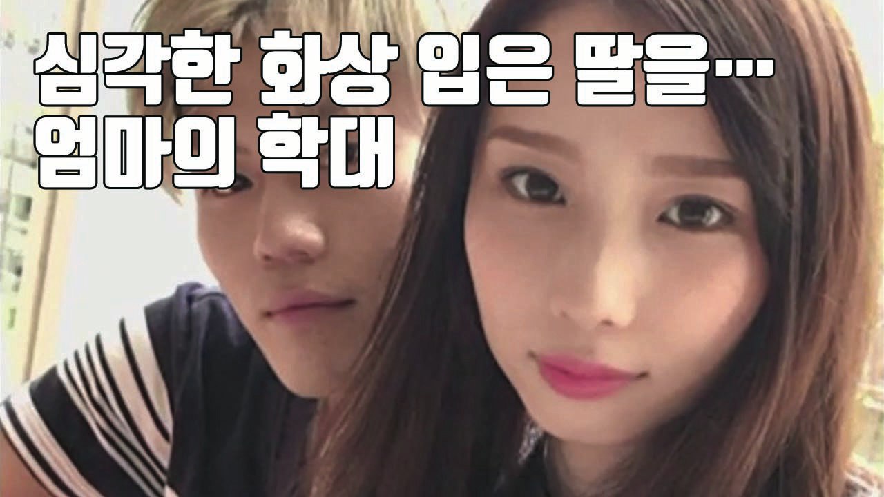 [자막뉴스] 심각한 화상 입은 딸 랩으로 둘둘...도박장 놀러 간 엄마 / YTN