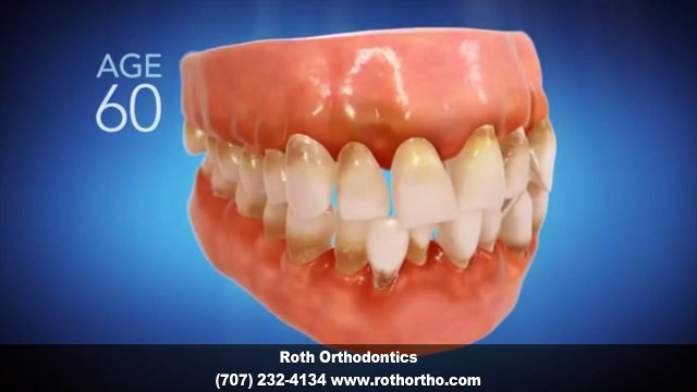 Invisalign Orthodontist Vacaville CA