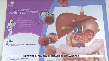 Pourquoi y a t’i autant de cas d’hépatite B aux Australes ?