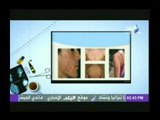 طبيب البلد مع يمنى طولان 23-4-2014