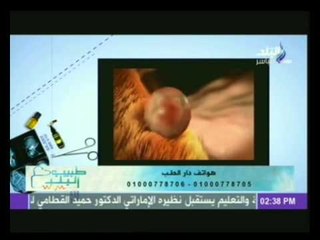 طبيب البلد مع يمنى طولان 8-5-2014
