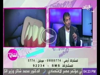فوائد وأضرار تبييض الاسنان مع الدكتورعماد ويليام