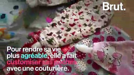 Charlène, 25 ans, atteinte du syndrome du grêle court