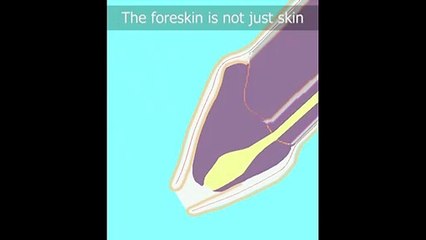 “Not just skin” re-upload.