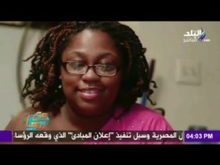 صدى البلد | سيدة تشرب 20 زجاجة برفان يومياً