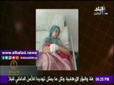 صدى البلد | برلمانية تناشد رئيس الوزراء بعلاج طالبة فقدت ساقها فدائًا لصديقتها