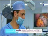 عملية تكميم المعدة لانقاص الوزن من داخل غرفة العمليات مع الدكتور محمد الفولى
