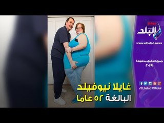 صدى البلد | فيديوجراف.. صاحبة أكبر معدة تبلغ 96 بوصة