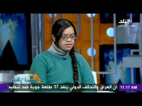 صدى البلد | الطفلة مريم معاقة تحدت الجميع فأصبحت بطلة العالم في السباحة