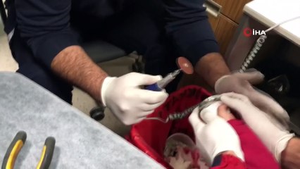 Küçük çocuğun parmağına sıkışan metal parça CANKUR ekipleri tarafından kesilerek çıkartıldı