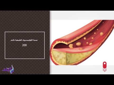 صدى البلد | أرقام تهم صحتك .. السكر والقلب والضغط