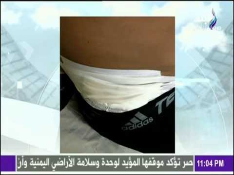 حصريا صور اصابة عمرو جمال بمطوة في بطنة في احداث شغب الالتراس | مع شوبير