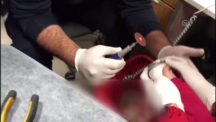 Çocuğun parmağına sıkışan metal halka acil serviste çıkarıldı - ADANA