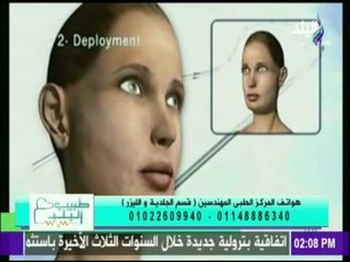 طبيب البلد | تعرفي على أحدث التقنيات لشد البشرة و علاج التحاعيد