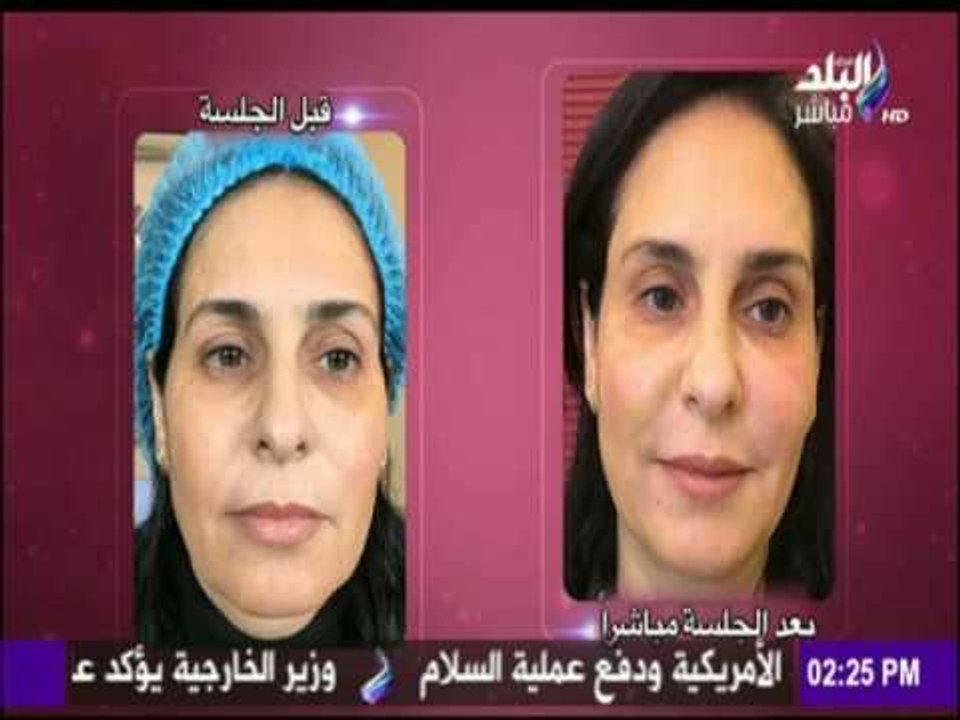 التقنيات الجديدة في عالم التجميل بدون عمليات جراحية
