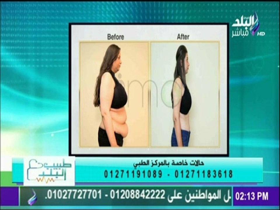 طبيب البلد - خطوات نحت الجسم و تنسيق القوام و إذابة الدهون