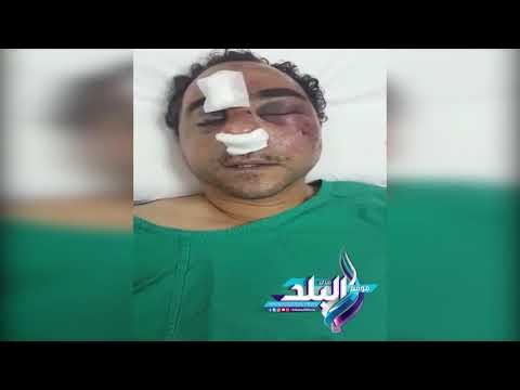 صدى البلد | الخارجية تتابع حالة مصري تعرض للضرب في الكويت