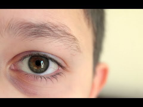 صدى البلد | فى حوار خاص لصدى البلد .. مصر لديها بنك واحد للتبرع بالقرنيات ..تعرف عليه