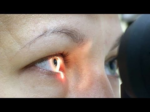 صدى البلد | استاذ طب وجراحة عيون لمرضى السكر:اتبعوا هذه العادات لتجنب العمى