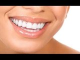 صدى البلد | تعرف على عوامل يجب مراعاتها عند وضع القشرة التجميلية للأسنان