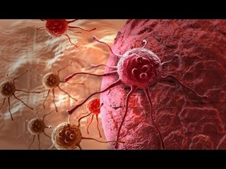 صدى البلد |  الكشف المبكر والتوعية يقللان من الإصابة بالأورام السرطانية