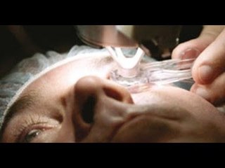 صدى البلد | تعرف على بديل عملية "تشريط العين"