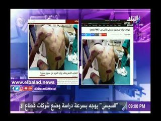 صدى البلد | أحمد موسى يكشف حقيقة صورة لتعذيب شخص نسبتها بعض المواقع لمصر