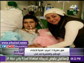 صدى البلد |أحمد موسى يعرض صوراً حصرية للطالبة «مريم» من داخل المستشفى بلندن