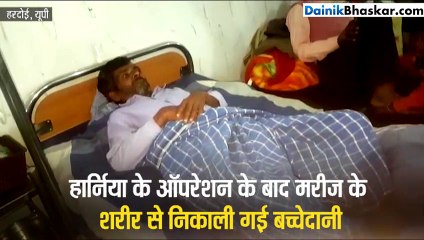 पेट दर्द से परेशान था 40 साल का शख्स, ऑपरेशन के उड़े डाक्टर्स के होश