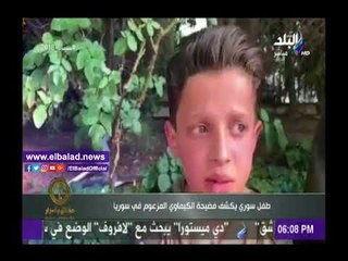 صدى البلد |شاهد .. طفل سوري يكشف أكاذيب تواجد الكيماوي في دوما .. وبكري يؤكد: المتآمرون يسقطون