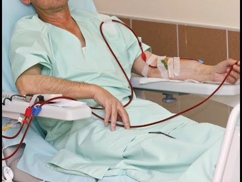 صدى البلد | حكم صيام مريض الفشل الكلوى